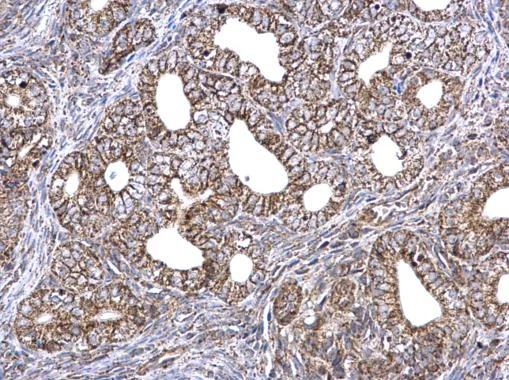 Immunohistochemistry (Formalin/PFA-fixed paraffin-embedded sections) - Anti-ETFA antibody (AB153722)