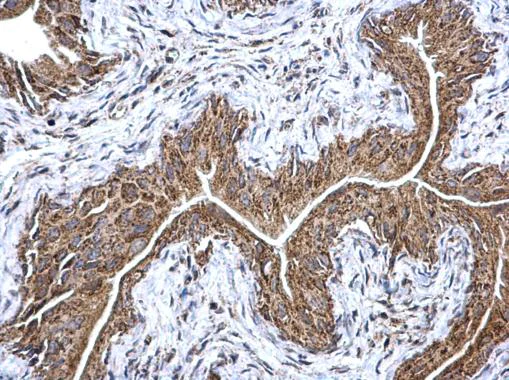 Immunohistochemistry (Formalin/PFA-fixed paraffin-embedded sections) - Anti-ETFA antibody (AB153722)