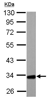 Western blot - Anti-ETFA antibody (ab153722), expandable thumbnail