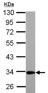 Western blot - Anti-ETFA antibody (ab153722), expandable thumbnail