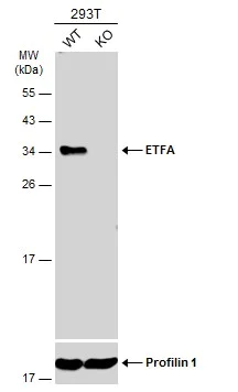 Western blot - Anti-ETFA antibody (AB153722)