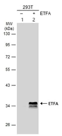 Western blot - Anti-ETFA antibody (AB153722)