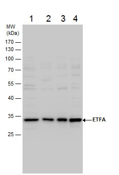 Western blot - Anti-ETFA antibody (AB153722), expandable thumbnail