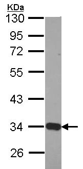 Western blot - Anti-ETFA antibody (ab153722), expandable thumbnail