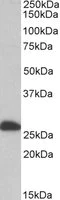 Western blot - Anti-ETFB antibody (AB104944)