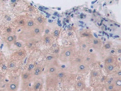 Immunohistochemistry (Formalin/PFA-fixed paraffin-embedded sections) - Anti-ETFB antibody (AB232815)