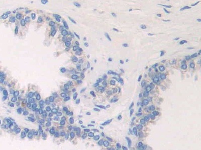 Immunohistochemistry (Formalin/PFA-fixed paraffin-embedded sections) - Anti-ETFB antibody (AB232815)