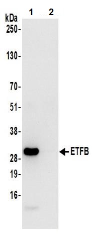 Immunoprecipitation - Anti-ETFB antibody (AB240593)