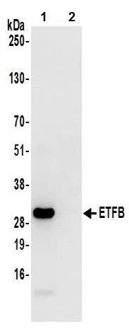 Immunoprecipitation - Anti-ETFB antibody (AB240593)