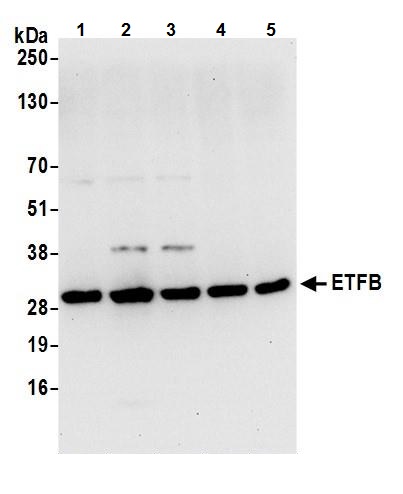 Western blot - Anti-ETFB antibody (AB240593)