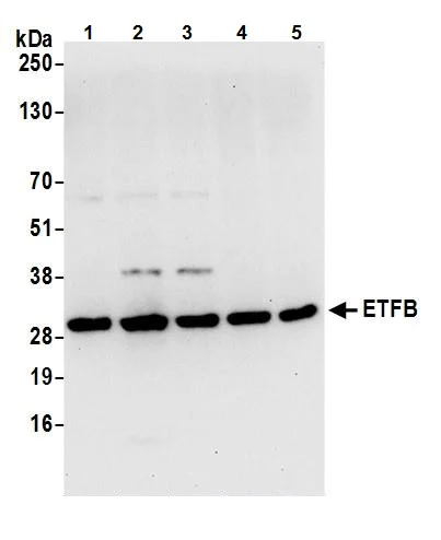 Western blot - Anti-ETFB antibody (AB240593)