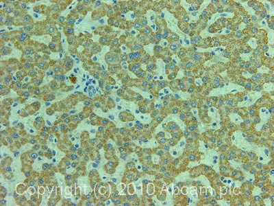 Immunohistochemistry (Formalin/PFA-fixed paraffin-embedded sections) - Anti-ETFB antibody (AB73986)