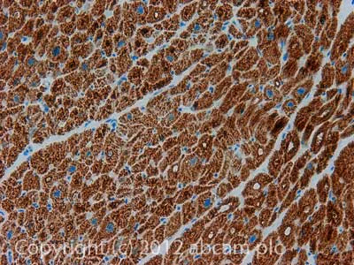 Immunohistochemistry (Formalin/PFA-fixed paraffin-embedded sections) - Anti-ETFDH antibody [3D1AC4AF3] (AB131376)