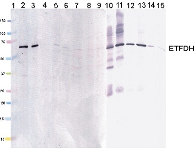 Western blot - Anti-ETFDH antibody [3D1AC4AF3] (AB131376), expandable thumbnail