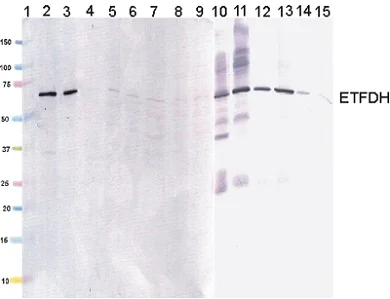Western blot - Anti-ETFDH antibody [3D1AC4AF3] (AB131376)