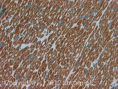 Immunohistochemistry (Formalin/PFA-fixed paraffin-embedded sections) - Anti-ETFDH antibody [3H2BG1] (AB126576)