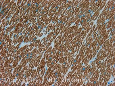 Immunohistochemistry (Formalin/PFA-fixed paraffin-embedded sections) - Anti-ETFDH antibody [3H2BG1] (AB126576)