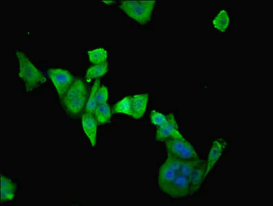 Immunocytochemistry/ Immunofluorescence - Anti-ETFDH antibody - C-terminal (AB224663)
