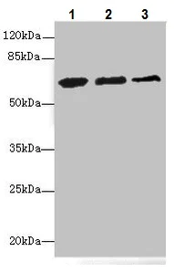 Western blot - Anti-ETFDH antibody - C-terminal (AB224663)