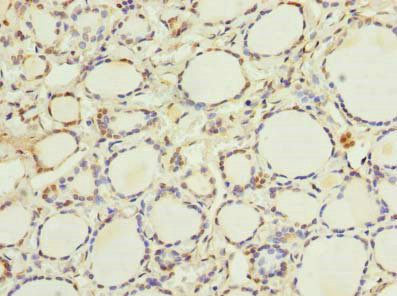 Immunohistochemistry (Formalin/PFA-fixed paraffin-embedded sections) - Anti-ethanolamine kinase antibody (AB236615)