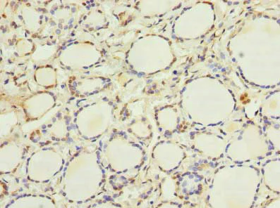 Immunohistochemistry (Formalin/PFA-fixed paraffin-embedded sections) - Anti-ethanolamine kinase antibody (AB236615)