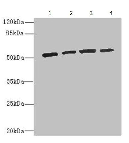 Western blot - Anti-ethanolamine kinase antibody (AB236615)
