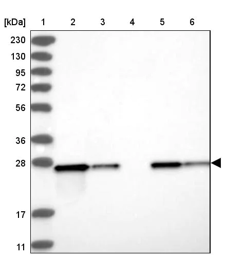 Western blot - Anti-ETHE1 antibody (AB251791)
