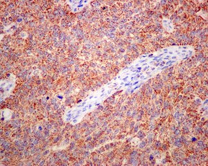 Immunohistochemistry (Formalin/PFA-fixed paraffin-embedded sections) - Anti-ETHE1 antibody [EPR11697] (AB174302)