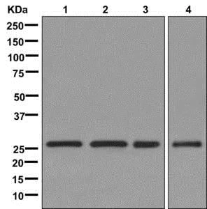 Western blot - Anti-ETHE1 antibody [EPR11697] - BSA and Azide free (AB249805)