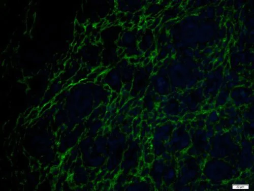 Immunohistochemistry (Formalin/PFA-fixed paraffin-embedded sections) - Anti-ETL antibody (AB217175)