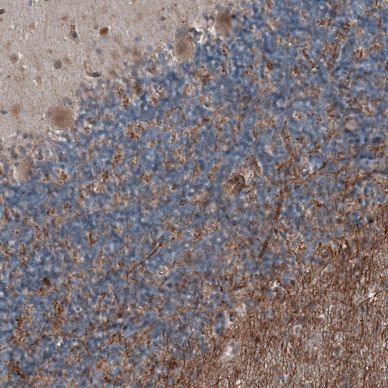 Immunohistochemistry (Formalin/PFA-fixed paraffin-embedded sections) - Anti-ETL antibody [CL4164] (AB219974)