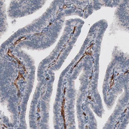 Immunohistochemistry (Formalin/PFA-fixed paraffin-embedded sections) - Anti-ETL antibody [CL4164] (AB219974)