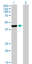 Western blot - Anti-ETNK2 antibody (AB168290)