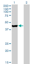 Western blot - Anti-ETNK2 antibody (AB168290)