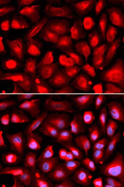 Immunocytochemistry/ Immunofluorescence - Anti-ETS1 antibody (AB186844)