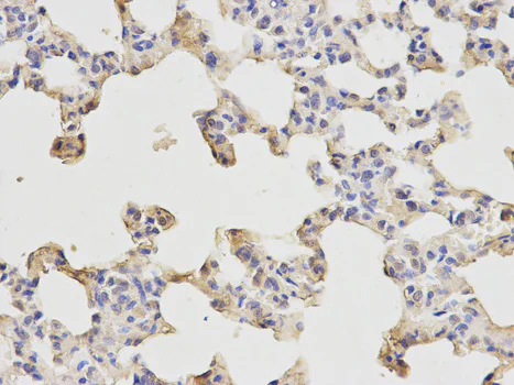 Immunohistochemistry (Formalin/PFA-fixed paraffin-embedded sections) - Anti-ETS1 antibody (AB186844)