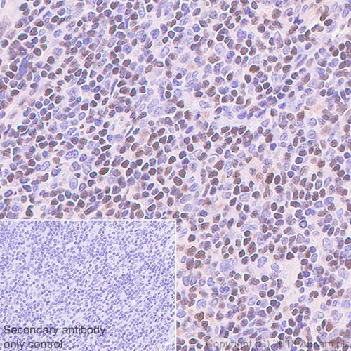 Immunohistochemistry (Formalin/PFA-fixed paraffin-embedded sections) - Anti-ETS1 antibody [EPR21909] (AB220361)