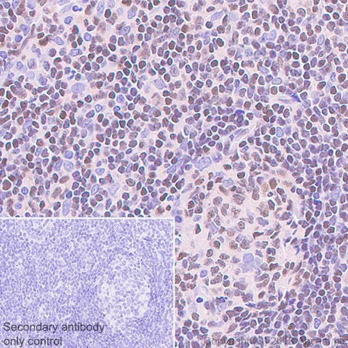 Immunohistochemistry (Formalin/PFA-fixed paraffin-embedded sections) - Anti-ETS1 antibody [EPR21909] (AB220361)