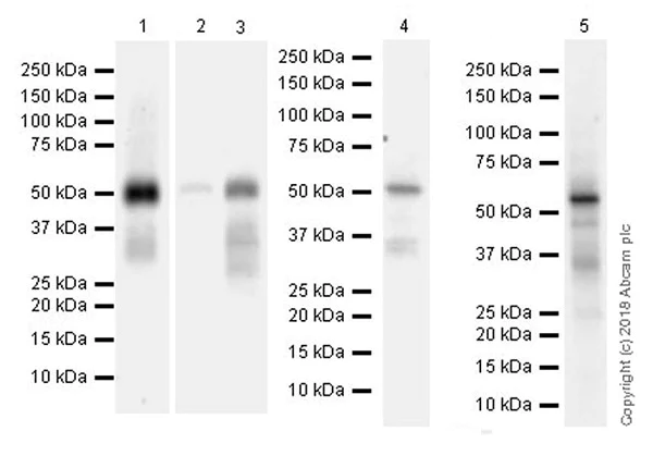 Western blot - Anti-ETS1 antibody [EPR21909] (AB220361)
