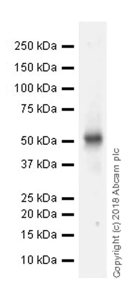 Western blot - Anti-ETS1 antibody [EPR21909] (AB220361)
