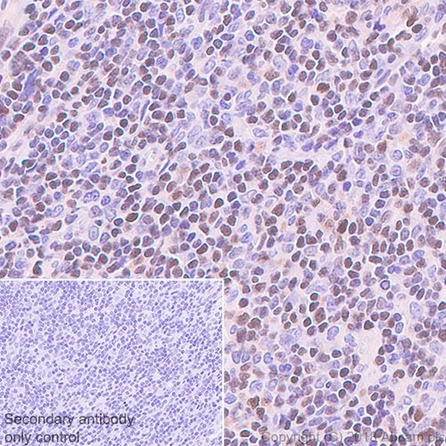 Immunohistochemistry (Formalin/PFA-fixed paraffin-embedded sections) - Anti-ETS1 antibody [EPR21909] - BSA and Azide free (AB238645)