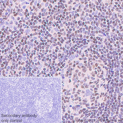 Immunohistochemistry (Formalin/PFA-fixed paraffin-embedded sections) - Anti-ETS1 antibody [EPR21909] - BSA and Azide free (AB238645)