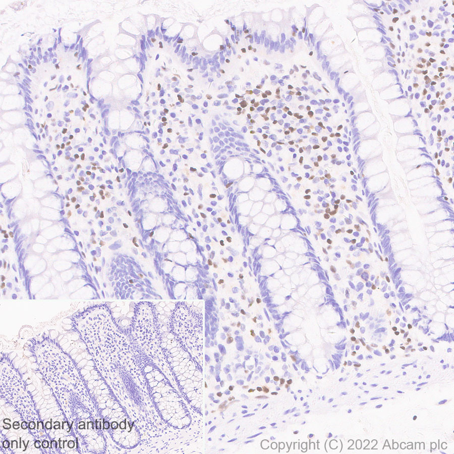 Immunohistochemistry (Formalin/PFA-fixed paraffin-embedded sections) - Anti-ETS1 antibody [EPR27353-81] (ab307672), expandable thumbnail