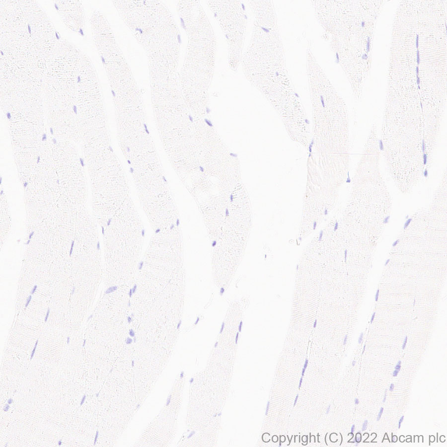 Immunohistochemistry (Formalin/PFA-fixed paraffin-embedded sections) - Anti-ETS1 antibody [EPR27353-81] (ab307672), expandable thumbnail