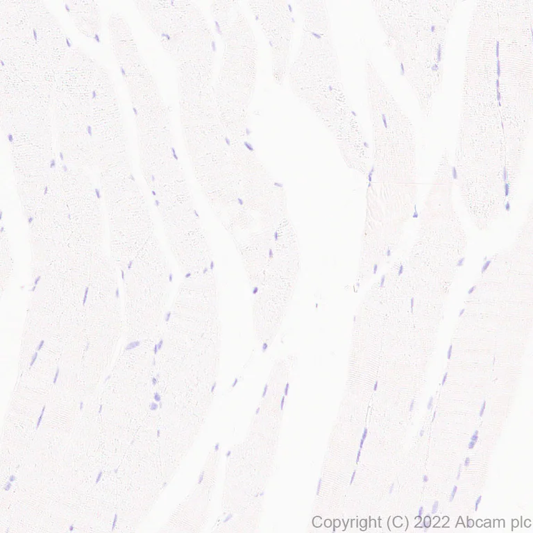Immunohistochemistry (Formalin/PFA-fixed paraffin-embedded sections) - Anti-ETS1 antibody [EPR27353-81] (AB307672)