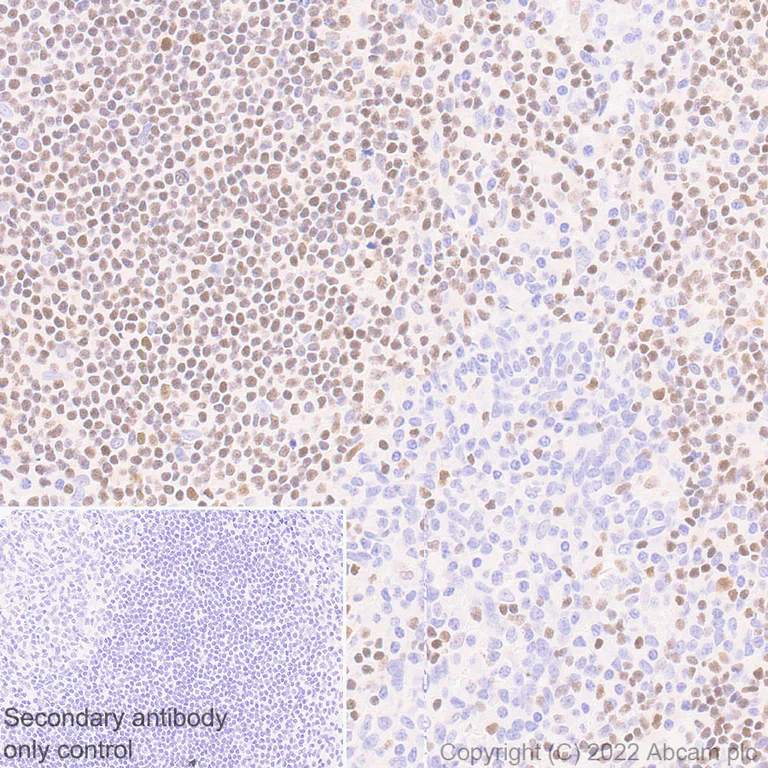 Immunohistochemistry (Formalin/PFA-fixed paraffin-embedded sections) - Anti-ETS1 antibody [EPR27353-81] (AB307672)