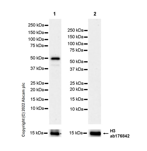 Western blot - Anti-ETS1 antibody [EPR27353-81] (ab307672), expandable thumbnail