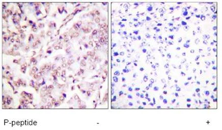 Immunohistochemistry (Formalin/PFA-fixed paraffin-embedded sections) - Anti-ETS1 (phospho T38) antibody (AB59179)