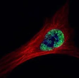 Immunocytochemistry/ Immunofluorescence - Anti-ETS2 antibody (AB272866)