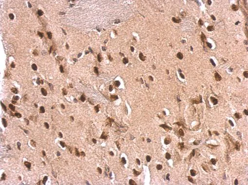 Immunohistochemistry (Formalin/PFA-fixed paraffin-embedded sections) - Anti-ETS2 antibody (AB272866)